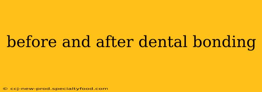 before and after dental bonding
