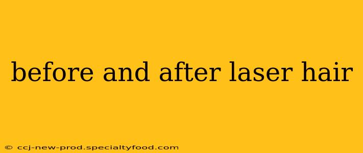before and after laser hair