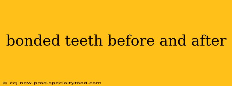 bonded teeth before and after