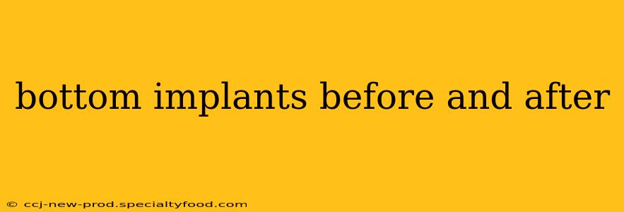 bottom implants before and after