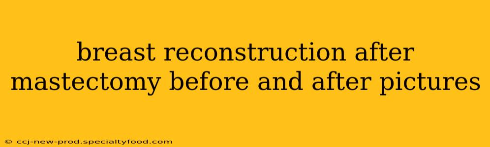 breast reconstruction after mastectomy before and after pictures
