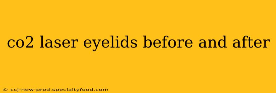 co2 laser eyelids before and after