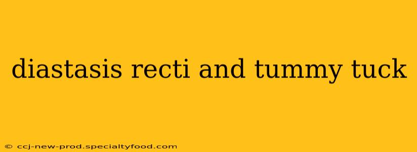 diastasis recti and tummy tuck