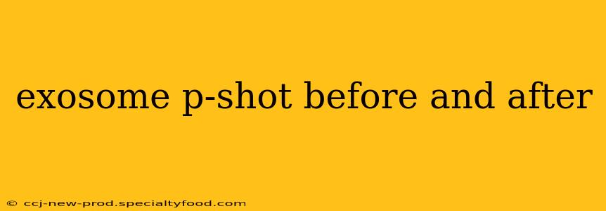 exosome p-shot before and after