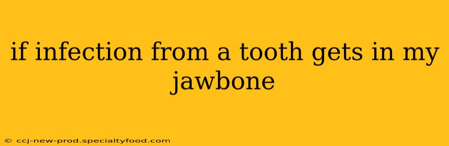 if infection from a tooth gets in my jawbone