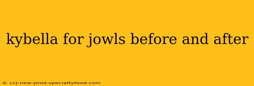 kybella for jowls before and after