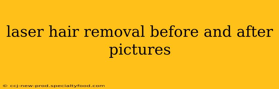 laser hair removal before and after pictures