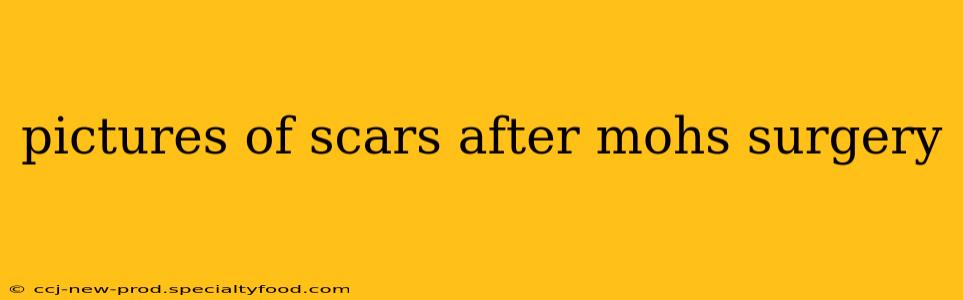 pictures of scars after mohs surgery