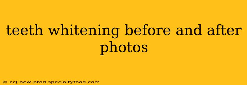 teeth whitening before and after photos