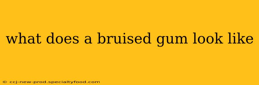 what does a bruised gum look like