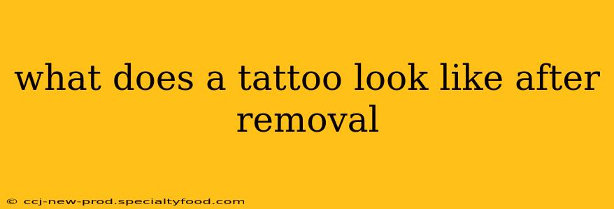 what does a tattoo look like after removal