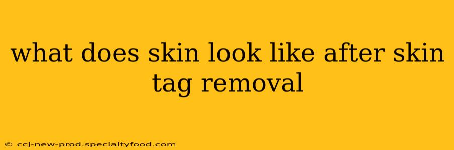 what does skin look like after skin tag removal