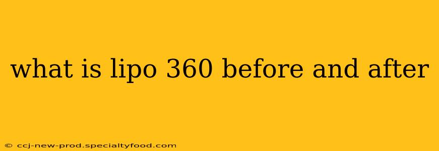 what is lipo 360 before and after